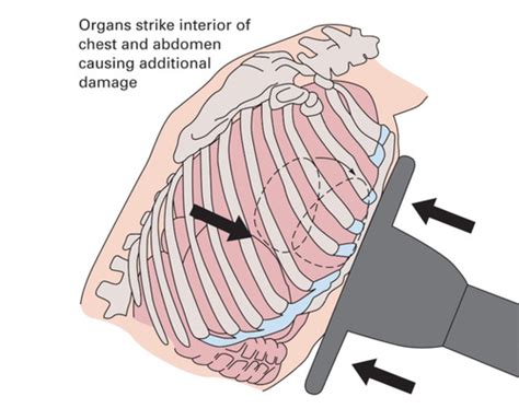 Chapter Trauma Overview The Trauma Patient And The Trauma System