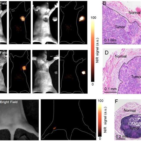 Nir Ii Fluorescence Imaging Guided Tumor Surgery Nir Ii Fluorescence