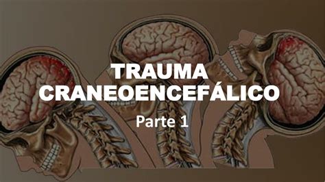 Traumatismo Craneoencef Lico Parte Nursemeed Udocz