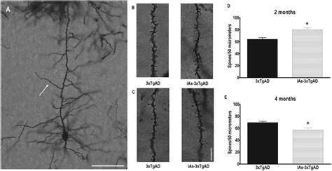 Dendritic spine density is altered in the layer III from... | Download ... 