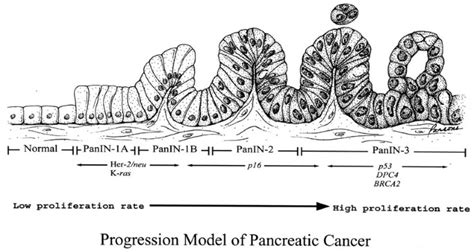 Direct Correlation Between Proliferative Activity And Dysplasia In