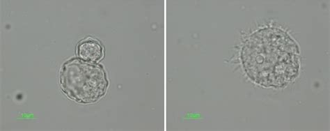 Trophozoite Right And Cyst Stages Left In Acanthamoeba Sp Download Scientific Diagram