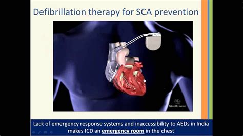 Sudden Cardiac Arrest Know The Risks And Prevention Youtube