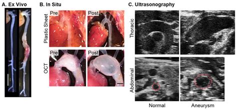 Biomolecules Free Full Text Imaging Techniques For Aortic Aneurysms