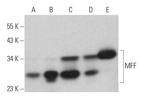 MFF抗体 C 11 SCBT Santa Cruz Biotechnology