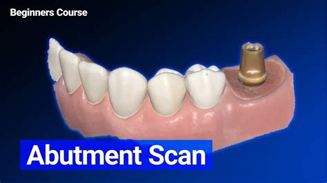 Der Vereinfachte Leitfaden Zum Scannen Von Abutments F R Zahn Rzte