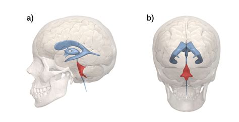 What Is The Floor Of Fourth Ventricle Brain Ct