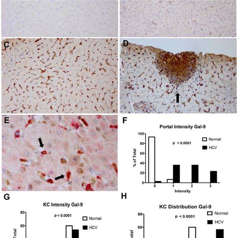 Galectin 9 Induces Cytokine Secretion From Liver Derived And Peripheral