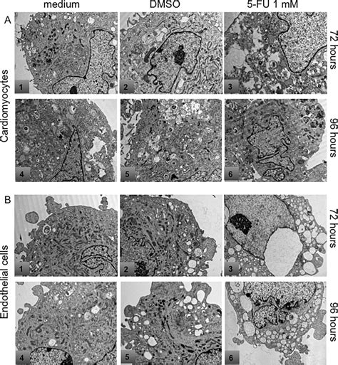 Ultrastructural analysis by electron microscopy. HCMs in culture ... 
