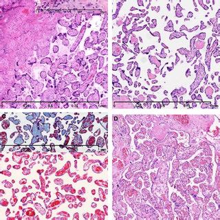 Placenta Histology