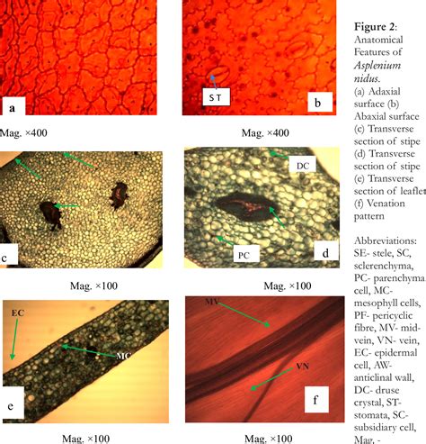Figure From Morphology And Anatomy Of Three Species Of Asplenium L