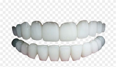 Human Teeth No Gums - Transparent Background Teeth Png, Png Download ...