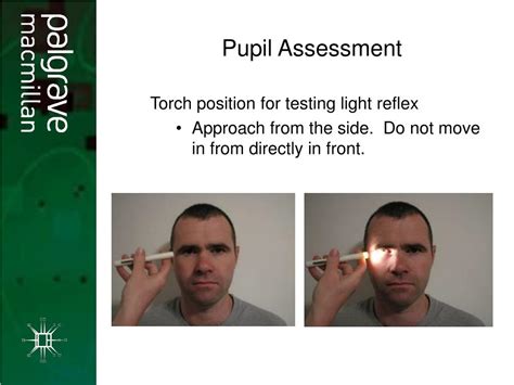 Ppt Neurological Assessment Neurological Assessment Powerpoint