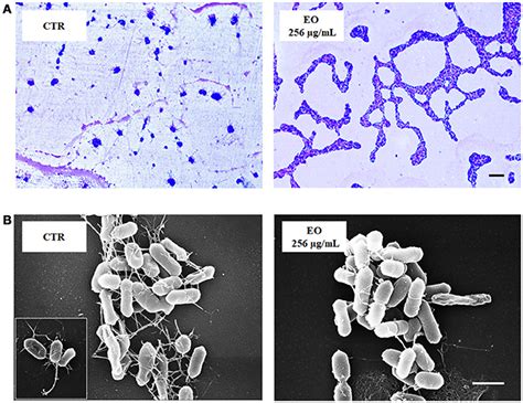 Listeria Gram Stain - halvedtapes