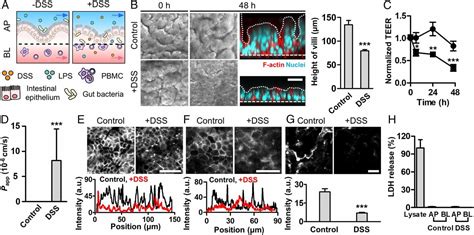 Intestinal Barrier Dysfunction Orchestrates The Onset Of Inflammatory