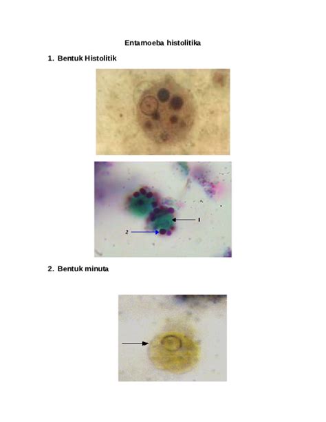 Doc Entamoeba Histolitika