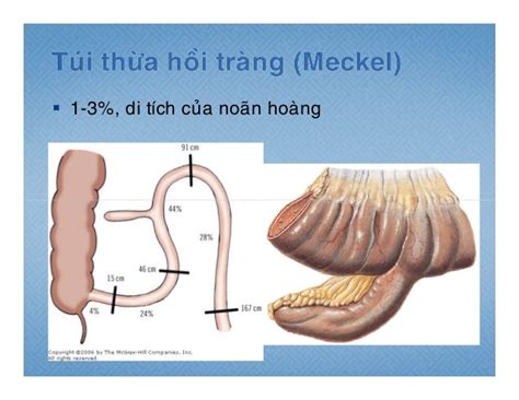 Giải Phẩu Ruột Non Ruột Già Yds