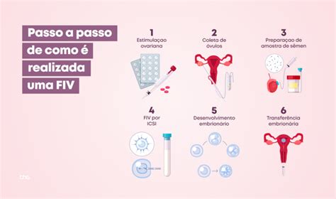 Passo A Passo De Como Realizada Uma Fiv Fertiliza O In Vitro