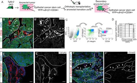 De-repression of the RAC activator ELMO1 in cancer stem cells drives ... 