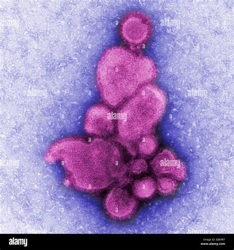 This Colorized Negatively Stained Transmission Electron Micrograph TEM