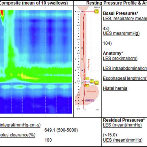 High Resolution Manometry Showing Panesophageal Pressurization And