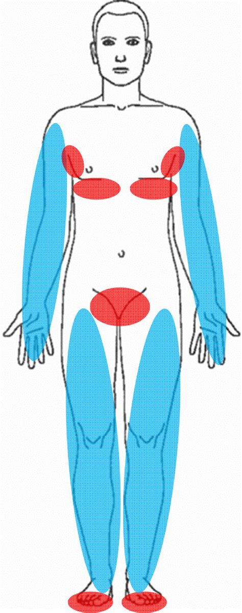 'Hot spots': skin may be either too dry (blue) or too moist (red). (For... | Download Scientific ...