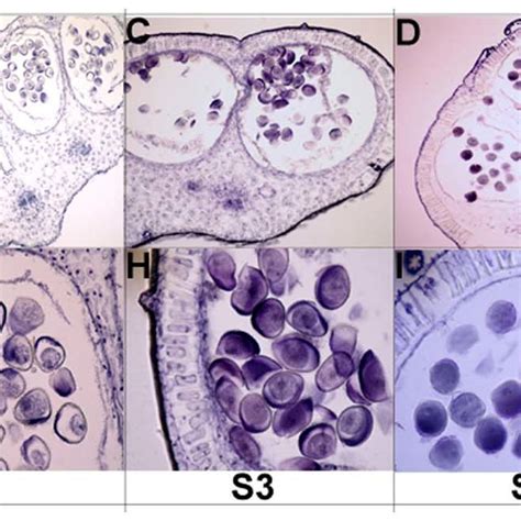 Longitudinal Paraffin Section Images Of Embryo Sac Arrow In Image D