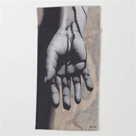 drawing blood bruise 4