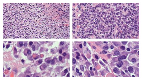 Plasma Cells Histology