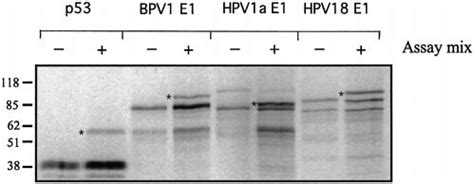 In Vitro Sumoylation Of HPV E1 Proteins In Vitro Translated P53 BPV