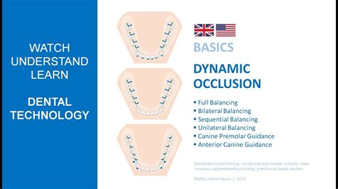 Dynamic Occlusion Concepts 2023 Basics YouTube