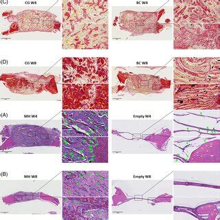 Histological Images From Specimens At Weeks 4 And 8 Including Cryogel