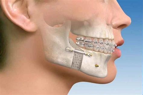 Jaw Fracture Dental Clinic In Jamnagar