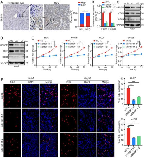 SRSF11 Knockdown Inhibits The CDK1 Dependent Cell Proliferation In HCC