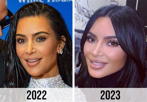 Fans Think Kim Kardashian Has Undergone More Surgery After She Debuts ...