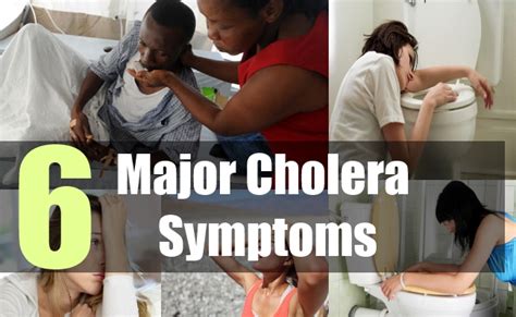 6 Major Cholera Symptoms Signs And Symptoms Of Cholera Disease Natural Home Remedies