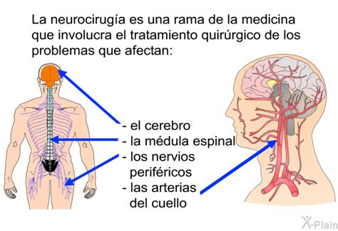 Patedu Qu Es La Neurocirug A