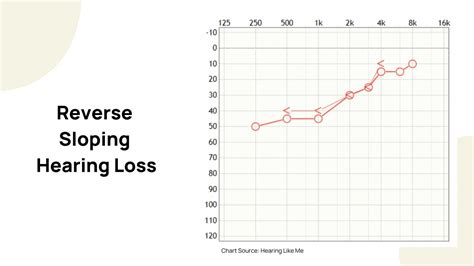 How To Read An Audiogram Dr Amy Sarow Explains