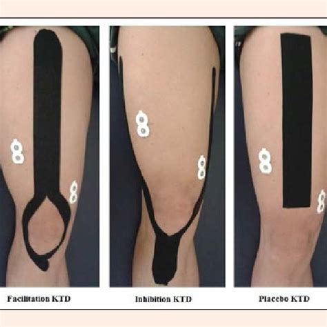 Pdf Effect Of 3 Different Applications Of Kinesio Taping Denko® On