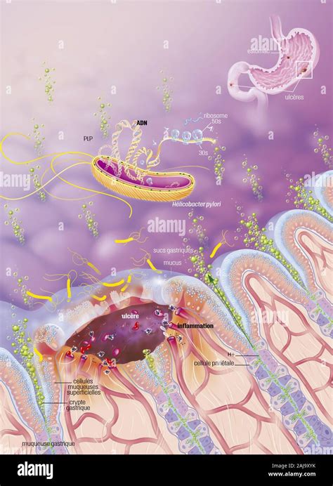 Gastric Ulcer Histology Hi Res Stock Photography And Images Alamy