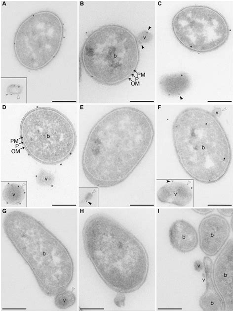 Enterohemorrhagic Escherichia Coli Hemolysin Employs Outer Membrane Vesicles To Target