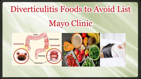 Printable List Of Foods To Avoid With Diverticulitis