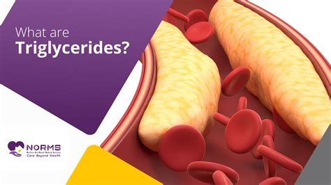 What Are Triglycerides