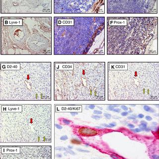 Overview of the immunohistochemical stains used on serial sections of a ...