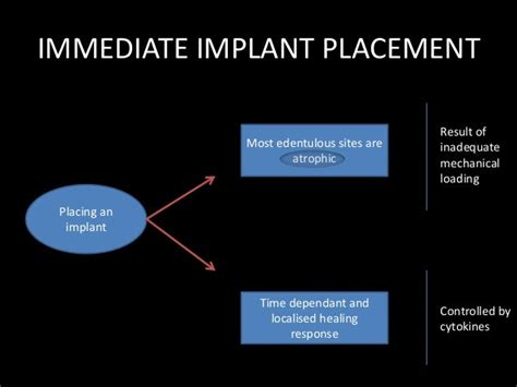 Immediate Implant Placement