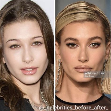 Hailey Bieber How To Make Hair Celebrity Plastic Surgery