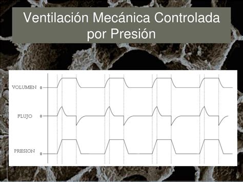 PPT Modos de Ventilación Mecánica PowerPoint Presentation free