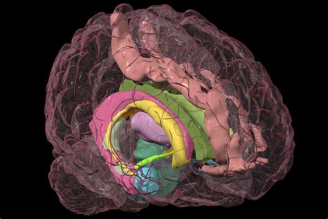 Brain Diagram Thalamus