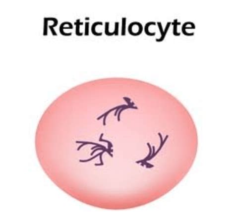 Reticulocyte Count Test - Medical Lab Technician Online Learning Platform