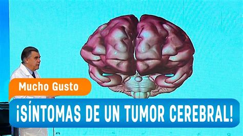 S Ntomas De Un Tumor Cerebral Mucho Gusto Youtube